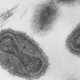 Microscopía electrónica del virus variola (imagen obtenida en 1975). Wikimedia Commosn
